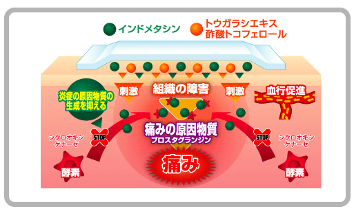 インドメタシン配合温湿布